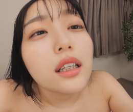 3DSVR-1650_teeth.png 3DSVR-1650_teeth.png