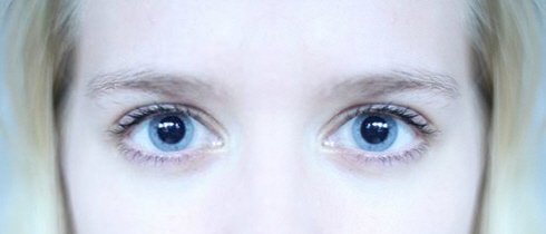 169-eye_pupils_dilated.jpg