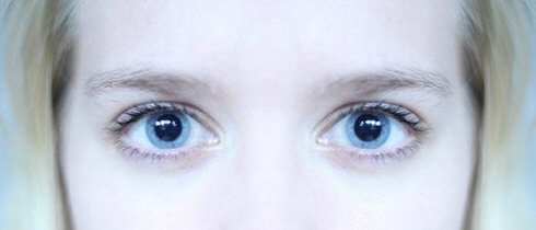 169-eye_pupils_dilated.jpg